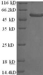 SDS-PAGE