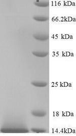 SDS-PAGE