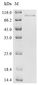SDS-PAGE