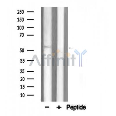 Валидация Affinity AF5376 - 3000