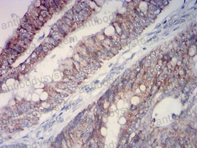 Валидация AntibodySystem RHH38002