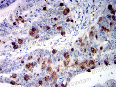 Валидация AntibodySystem RHF78601
