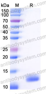 YHC01702, SDS-PAGE