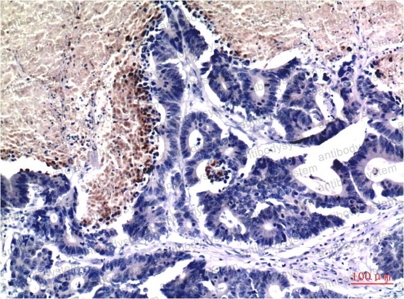 Валидация AntibodySystem RHF62745 (2630)