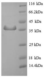 SDS-PAGE