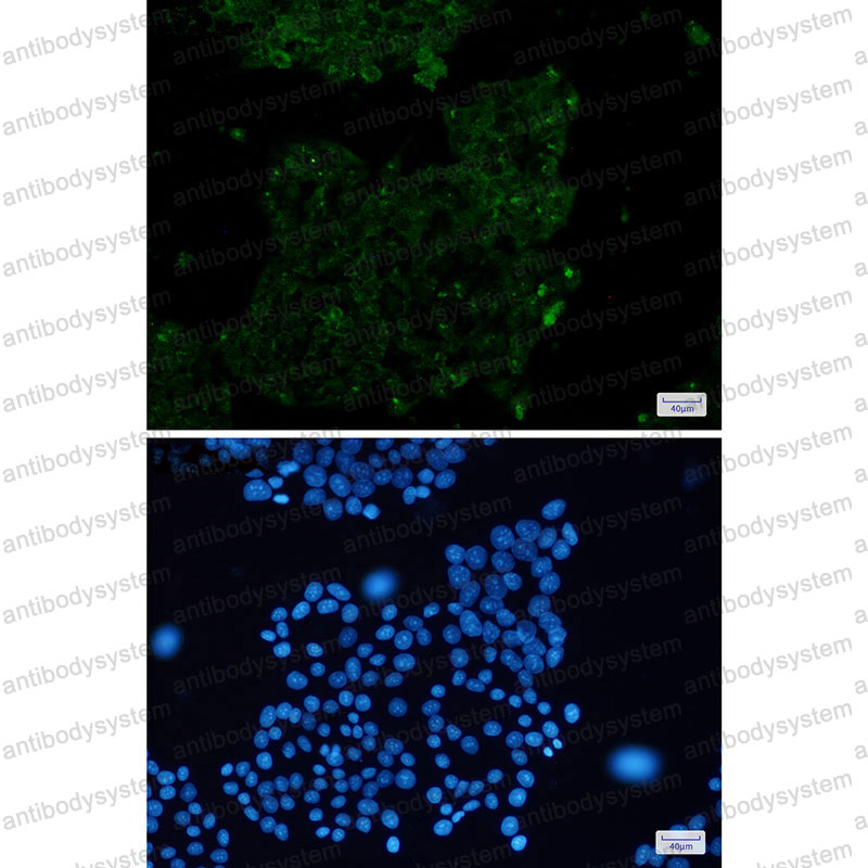 Валидация IF - AntibodySystem RHF62106