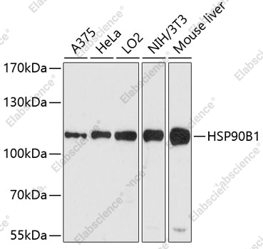 Вестерн-блоттинг, HSP90B1, различные клеточные линии