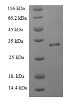 SDS-PAGE