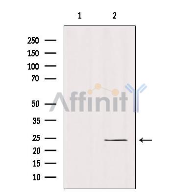 Валидация Affinity DF9835 - 22731