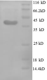 SDS-PAGE