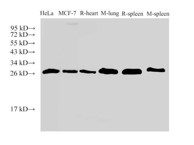 Вестерн-блоттинг, Galectin 3, клетки HeLa, MCF-7 и ткани сердца крысы, легких мыши, селезенки крысы и мыши