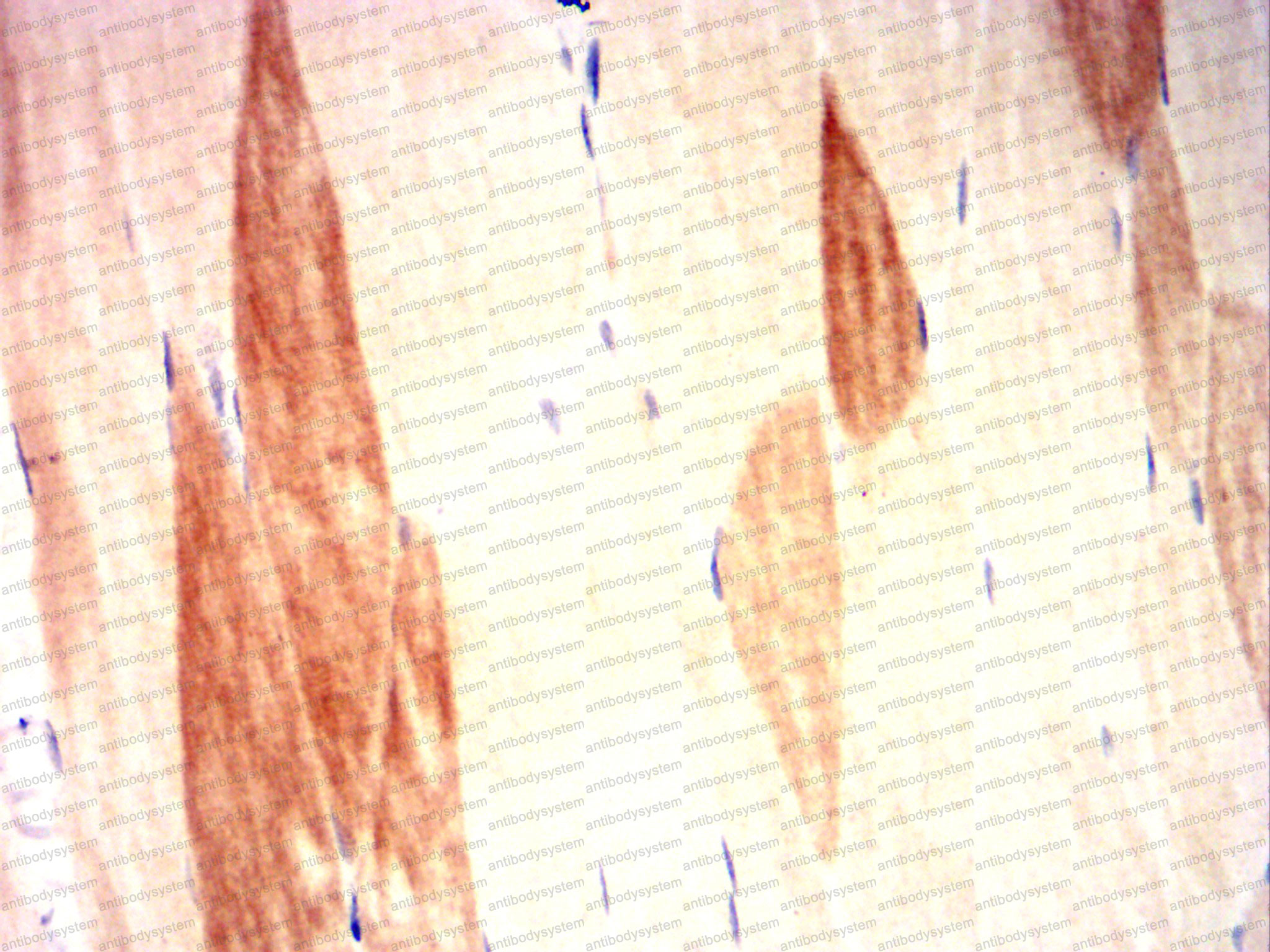 Валидация AntibodySystem RHG72104