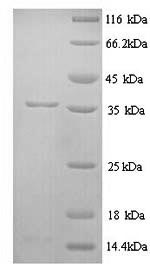 SDS-PAGE