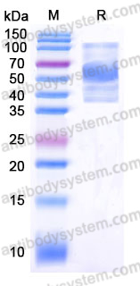 EHE07701, SDS-PAGE