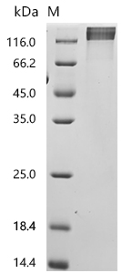 SDS-PAGE
