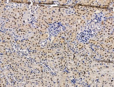 Валидация Affinity DF15395 - 11711