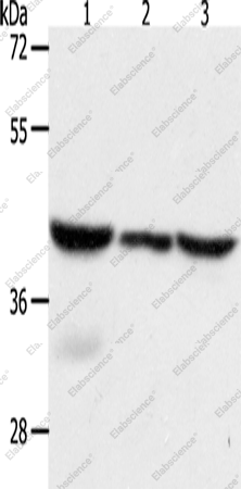 Вестерн-блоттинг, CAPG, ткань легкого мыши и человека, клетки HeLa
