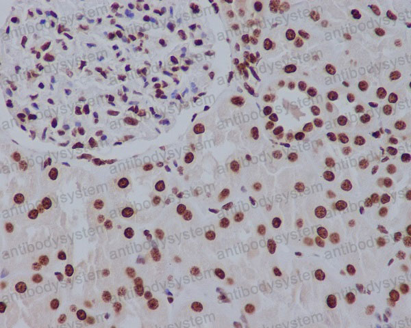 Валидация AntibodySystem RHC45601