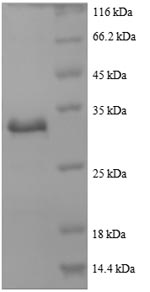 SDS-PAGE