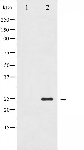 Валидация Affinity AF6215 - 3456