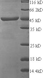 SDS-PAGE