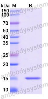 Валидация SDS-PAGE - AntibodySystem RWN10004