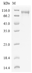 SDS-PAGE