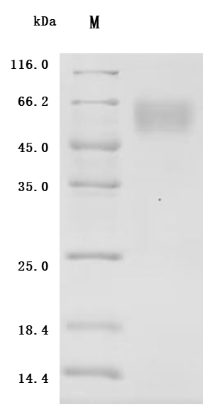 SDS-PAGE