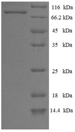 SDS-PAGE