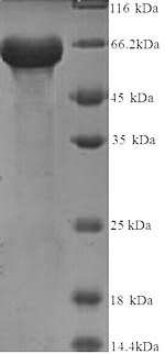 SDS-PAGE