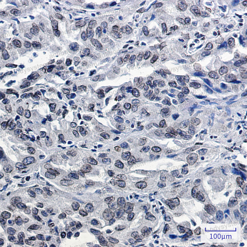 Валидация AntibodySystem RHF98701