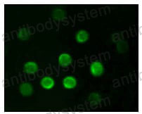 Валидация IF - AntibodySystem RHC90702