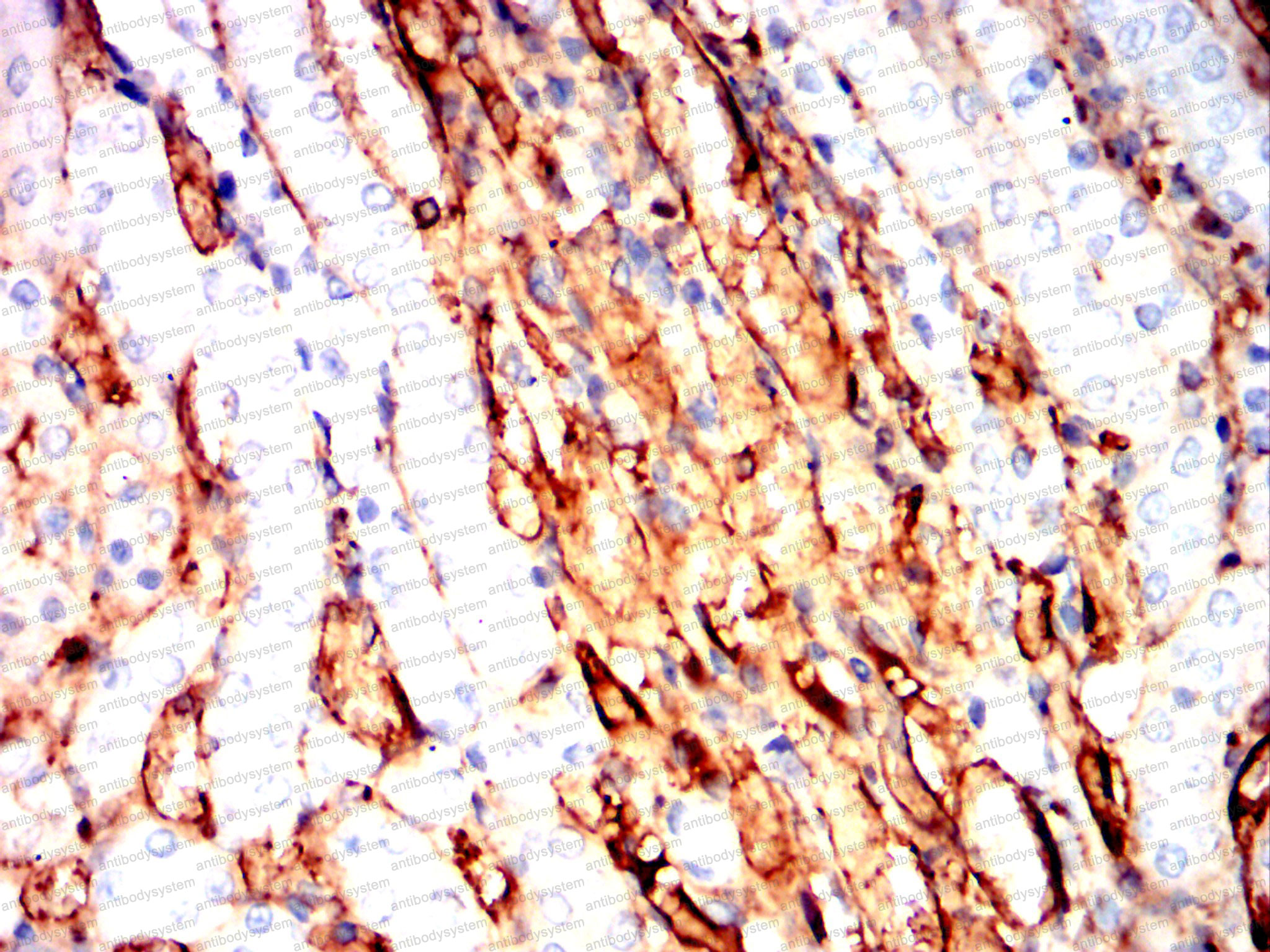 Валидация AntibodySystem RHE18301 (2020)
