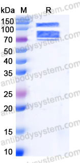 EHB87902, SDS-PAGE