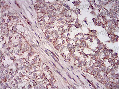 Валидация AntibodySystem RHD46603 (1595)