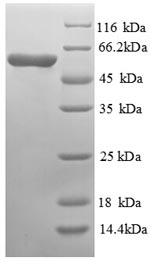 SDS-PAGE