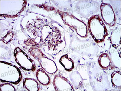 Валидация AntibodySystem RHN28601