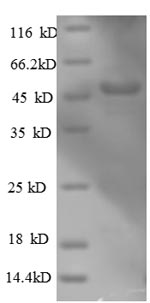 SDS-PAGE