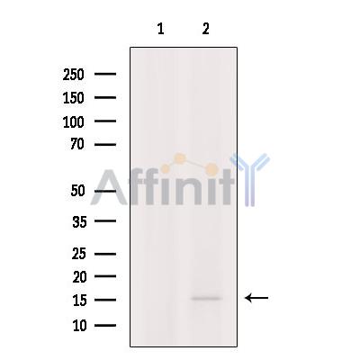 Валидация Affinity AF9050 - 4795