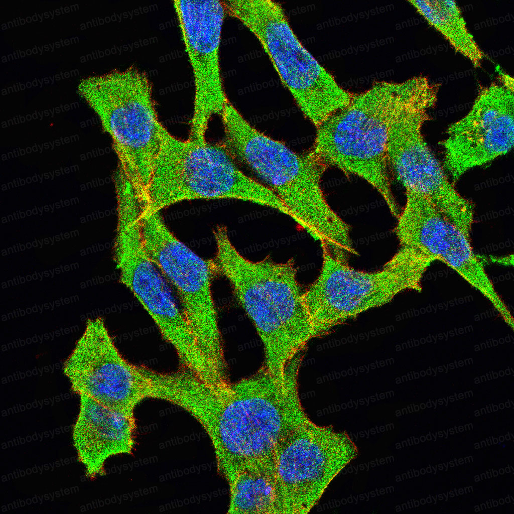 Валидация IF - AntibodySystem RHC84902