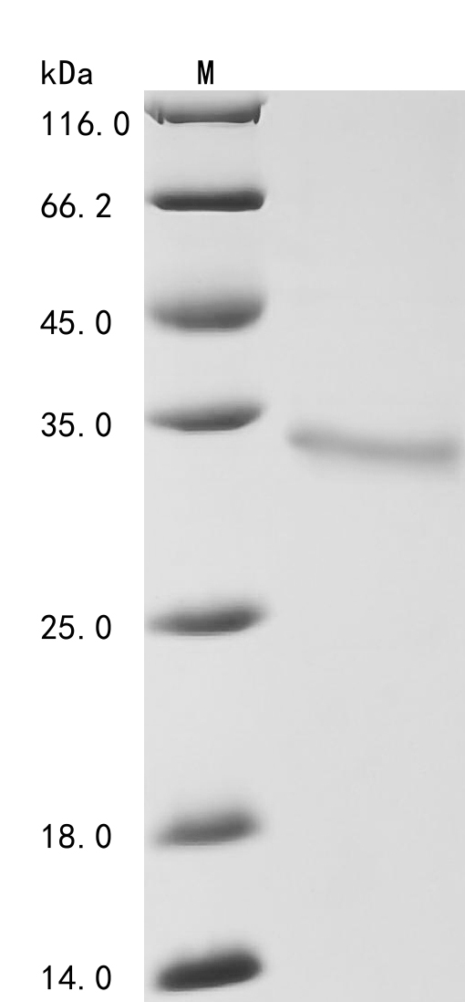 SDS-PAGE