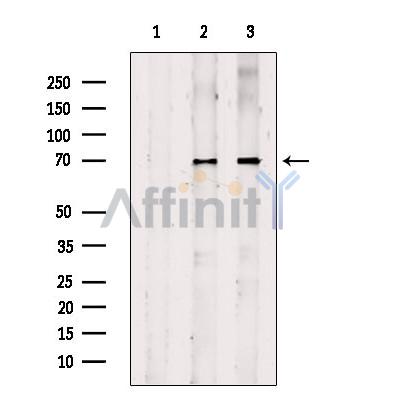 Валидация Affinity DF12004 - 6000