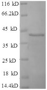 SDS-PAGE