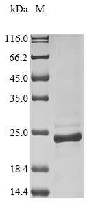 SDS-PAGE