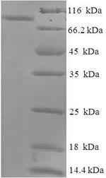 SDS-PAGE