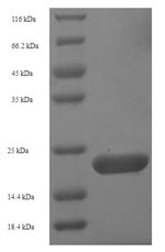 SDS-PAGE