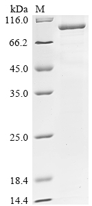 SDS-PAGE