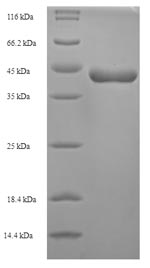SDS-PAGE