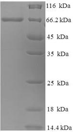 SDS-PAGE