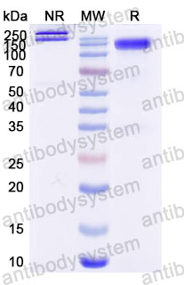 Валидация SDS-PAGE - AntibodySystem DHB95603